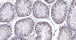 RASA1 Antibody in Immunohistochemistry (Paraffin) (IHC (P))