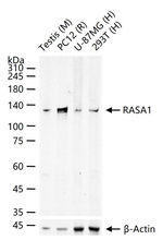 RASA1 Antibody in Western Blot (WB)