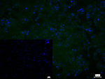 CAP1 Recombinant Rabbit Monoclonal Antibody (2B6)