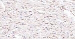 CAP1 Antibody in Immunohistochemistry (Paraffin) (IHC (P))