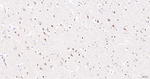 DCAF7 Antibody in Immunohistochemistry (Paraffin) (IHC (P))