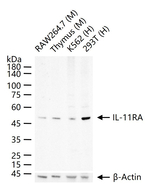 IL11RA Recombinant Rabbit Monoclonal Antibody (5C11)