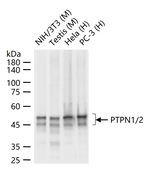 PTP1B/PTPN2 Recombinant Rabbit Monoclonal Antibody (5H9)
