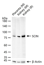 SCIN Recombinant Rabbit Monoclonal Antibody (10B6)