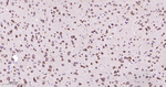TXNDC12 Antibody in Immunohistochemistry (Paraffin) (IHC (P))