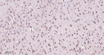 TXNDC12 Antibody in Immunohistochemistry (Paraffin) (IHC (P))