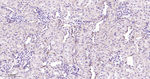 TXNDC12 Antibody in Immunohistochemistry (Paraffin) (IHC (P))