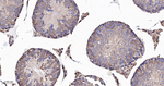 MRLC2 Antibody in Immunohistochemistry (Paraffin) (IHC (P))