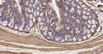 MRLC2 Antibody in Immunohistochemistry (Paraffin) (IHC (P))