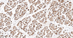 MRLC2 Antibody in Immunohistochemistry (Paraffin) (IHC (P))