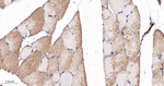 MRLC2 Antibody in Immunohistochemistry (Paraffin) (IHC (P))