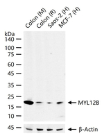 MRLC2 Antibody in Western Blot (WB)