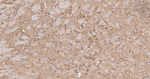 UQCRH Antibody in Immunohistochemistry (Paraffin) (IHC (P))