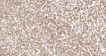 UQCRH Antibody in Immunohistochemistry (Paraffin) (IHC (P))