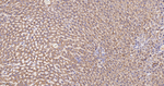 UQCRH Antibody in Immunohistochemistry (Paraffin) (IHC (P))