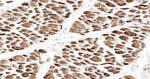 UQCRH Antibody in Immunohistochemistry (Paraffin) (IHC (P))