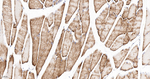 UQCRH Antibody in Immunohistochemistry (Paraffin) (IHC (P))