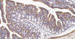 UQCRH Antibody in Immunohistochemistry (Paraffin) (IHC (P))