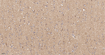 UQCRH Antibody in Immunohistochemistry (Paraffin) (IHC (P))