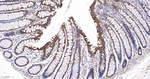 UQCRH Antibody in Immunohistochemistry (Paraffin) (IHC (P))