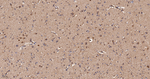 UQCRH Antibody in Immunohistochemistry (Paraffin) (IHC (P))