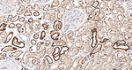 UQCRH Antibody in Immunohistochemistry (Paraffin) (IHC (P))