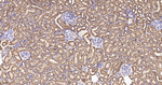 UQCRH Antibody in Immunohistochemistry (Paraffin) (IHC (P))