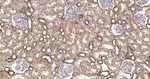 UQCRH Antibody in Immunohistochemistry (Paraffin) (IHC (P))