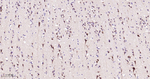 STX16 Antibody in Immunohistochemistry (Paraffin) (IHC (P))