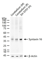 STX16 Antibody in Western Blot (WB)