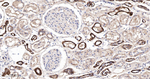 TRPV5 Antibody in Immunohistochemistry (Paraffin) (IHC (P))