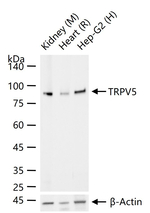TRPV5 Antibody in Western Blot (WB)