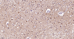 Kallikrein 8 Antibody in Immunohistochemistry (Paraffin) (IHC (P))
