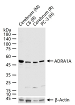 alpha-1a Adrenergic Receptor Recombinant Rabbit Monoclonal Antibody (11C3)