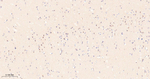ALS2CR1 Recombinant Rabbit Monoclonal Antibody (4D12)