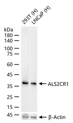 ALS2CR1 Antibody in Western Blot (WB)
