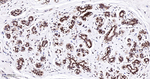 BAG1 Antibody in Immunohistochemistry (Paraffin) (IHC (P))