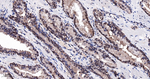 BAG1 Antibody in Immunohistochemistry (Paraffin) (IHC (P))
