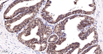 BAG1 Antibody in Immunohistochemistry (Paraffin) (IHC (P))