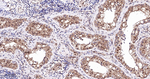 BAG1 Antibody in Immunohistochemistry (Paraffin) (IHC (P))