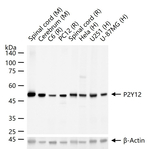 P2Y12 Recombinant Rabbit Monoclonal Antibody (17H15)