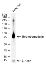 CD141 Antibody in Western Blot (WB)