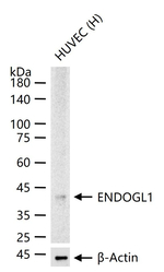 ENDOGL1 Recombinant Rabbit Monoclonal Antibody (6E8)