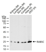 RAB5C Antibody in Western Blot (WB)