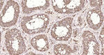 NCK2 Antibody in Immunohistochemistry (Paraffin) (IHC (P))