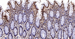 ALDH7A1 Antibody in Immunohistochemistry (Paraffin) (IHC (P))