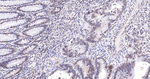 ALDH7A1 Antibody in Immunohistochemistry (Paraffin) (IHC (P))