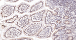 ALDH7A1 Antibody in Immunohistochemistry (Paraffin) (IHC (P))