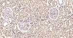 ALDH7A1 Antibody in Immunohistochemistry (Paraffin) (IHC (P))