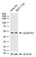 ALDH7A1 Antibody in Western Blot (WB)